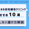 池袋にある自毛植毛クリニックおすすめ10選【後悔しない選び方解説】